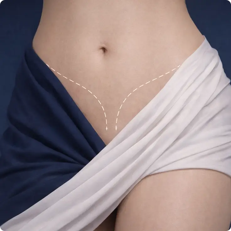 Genital Aesthetic